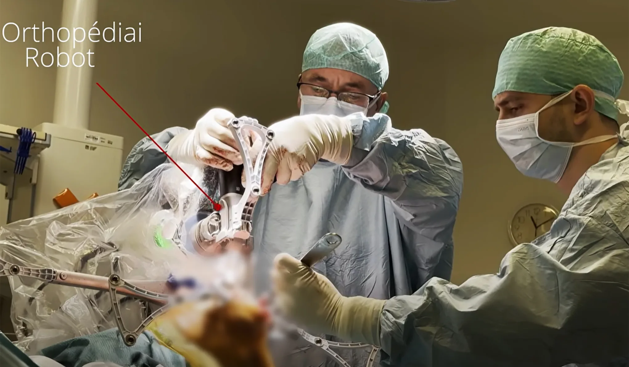 Először műtöttek térdet robottal magyar állami kórházban