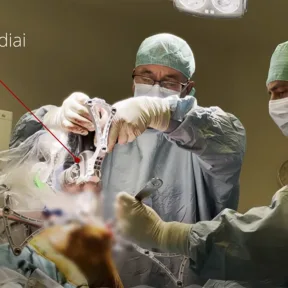 Először műtöttek térdet robottal magyar állami kórházban